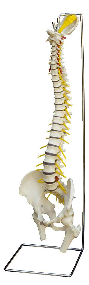 Anatomisches Modell "Wirbelsäule mit Bandscheibenvorfall" Unkategorisiert online kaufen