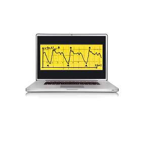Swimsportec PC-Software "Bio SwimAnalysis" Unkategorisiert online kaufen